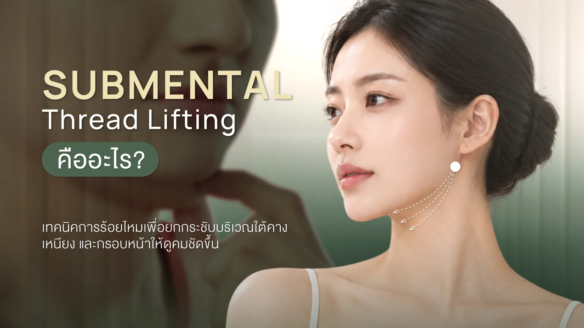 Submental Thread Lifting คืออะไร บริเวณใต้คาง เหนียง และกรอบหน้าล่าง